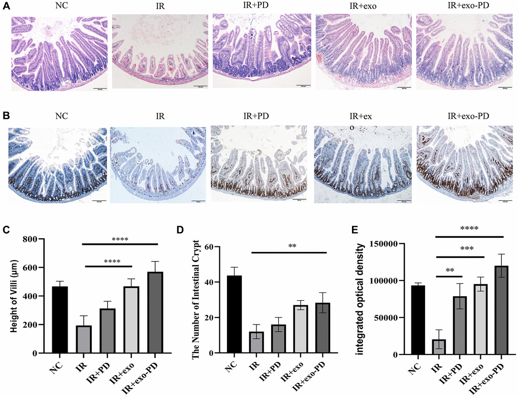 Small intestinal HE and immunohistochemical results after IR in mice. (A) Intestinal HE for each group of mice after irradiation. (B) Ki67 staining results of intestinal tissue. (C, D) Statistical plots of height of villi and number of intestinal crypts reflecting the results of Figure (A). (E) Integrated optical density about Ki67 staining results of intestinal tissue from Figure (B). Three typical sections for each group, comparisons between 100× and 200×, 4 fields of view per section. Statistical plots with * as p ** as P *** as p **** as p 