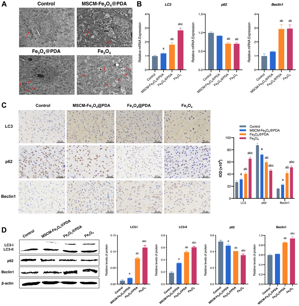 Effects of MSCM-Fe3O4@PDA, Fe3O4@PDA and Fe3O4 NPs on autophagy. (A) Ultrastructure of autophagy in neurons under electron microscope (autophagy shown by arrow). (B) Detection of p62, LC3, and Beclin 1 mRNA levels by RT-qPCR. (C) The representative pictures and statistical chart of LC3, p62 and Beclin 1 protein by immunohistochemistry. (D) Detection of LC3-I, LC3-II, p62 and Beclin 1 protein by western blot. ap bp 3O4@PDA, cp 3O4@PDA.