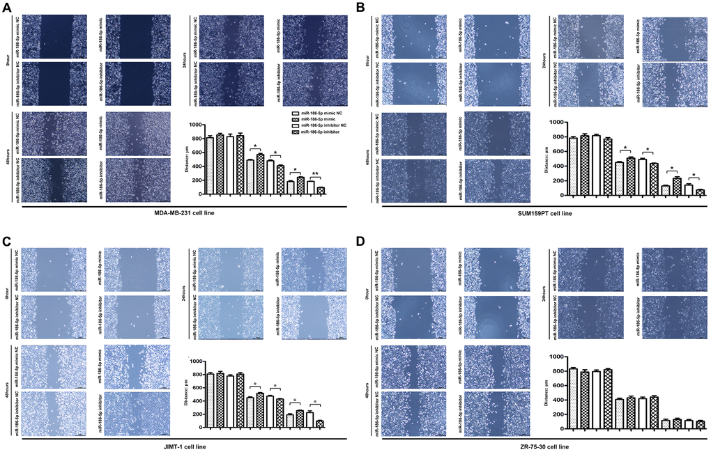 Scratch assay was used to detect the migration ability of MDA-MB-231, SUM159PT, JIMT-1, but not ZR-75-30 cells in each group. (A–D) showed the image of the migration area 0 h, 24 h and 48 h after the scratch manufacturing, respectively. Statistical results of scratch distance of MDA-MB-231 cells in each group. *P **P 