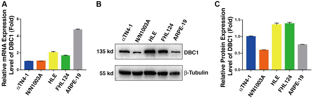 DBC1 expression patterns in different ocular cell lines. (A) Quantitative RT-PCR analysis showed mRNA levels of DBC1 in four different lens epithelial cell lines (αTN4-1, N/N1003A, HLE, FHL124) and one retinal pigment epithelial cell line (ARPE-19). Ct values were normalized by β-actin for each sample. The primers of DBC1 and β-actin were designed from mouse, rabbit and human species, the sequence details can refer to Supplementary Table 1. (B) Western blot analysis of DBC1 protein level in these ocular cell lines. β-tubulin served as the loading control. (C) Quantification of the Western blot results in panel (B).