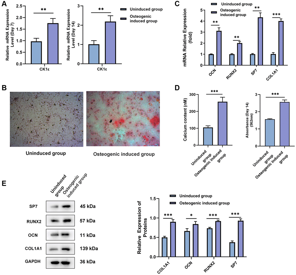 Identification and confirmation of the OD of rat BMSCs. (A) BMSCs were divided into uninduced and osteogenic induced groups. The relative mRNA expression level of CK1ε was detected by qRT-PCR analysis after 7 and 14 days of incubation. (B) ARS of BMSC osteoblasts after two weeks of incubation. (C) The relative mRNA expression levels of OCN, RUNX2, SP7, and COL1A1 were detected by qRT-PCR after two weeks of incubation. (D) Qualitative analysis for ARS, and intracellular calcium concentration were detected after two weeks of induction. (E) Relative protein expression levels and semi-quantitative analysis of SP7, RUNX2, OCN, and COL1A1 after two weeks of incubation. The experiments in this figure were repeated three times, and similar results were obtained. Student’s t-test was used for (A, C, D, E). The data are presented as the means ± SD of independent experiments. *P **P ***P 