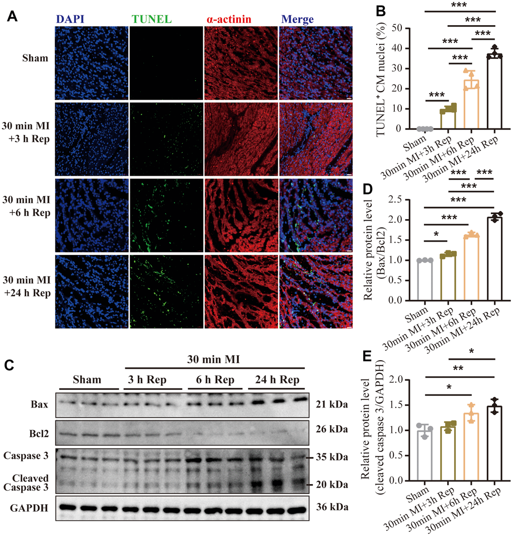 Progression of apoptotic cell after ischemia and reperfusion. (A) Representative images of immunofluorescence staining and (B) quantification of the TUNEL positive cardiomyocytes in mouse hearts treated as indicated (n = 4 : 4 : 4 : 4) Scale bar: 100 μm. (C) Representative western blot and (D, E) statistical data of myocardium apoptosis by detection of Bax, Bcl2, and Cleaved-Caspase 3 expression levels in mouse hearts treated as indicated (n = 3 : 3 : 3 : 3). MI=Myocardial infarction, Rep=reperfusion. Data are shown as mean ± SD. One-way ANOVA followed by Tukey post hoc test was used for statistical comparisons between multiple groups. *P P P 