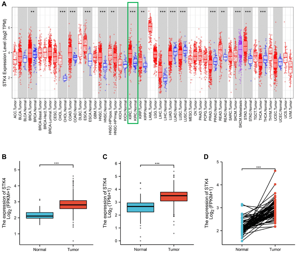 Differential expression of STK4 between tumors and adjacent normal tissues. STK4 expression in multiple tumors and normal tissues based on the TIMER database (A). STK4 expression in ccRCC tissues and normal tissues by using GTEx database and TCGA database (p B, C). STK4 expression in ccRCC tissues and adjacent tissues (p D).