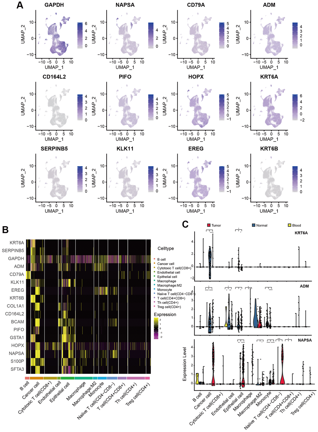 Expression pattern of PAMGs in different types of cells. (A) Expression of 17 PAMGs in three sample types. (B) Heatmap of 17 PAMGs in different types of cells. (C) Box plot of 3 representative genes expression (KRT6A, NASPA, and ADM) among tumor, blood, and normal tissues.