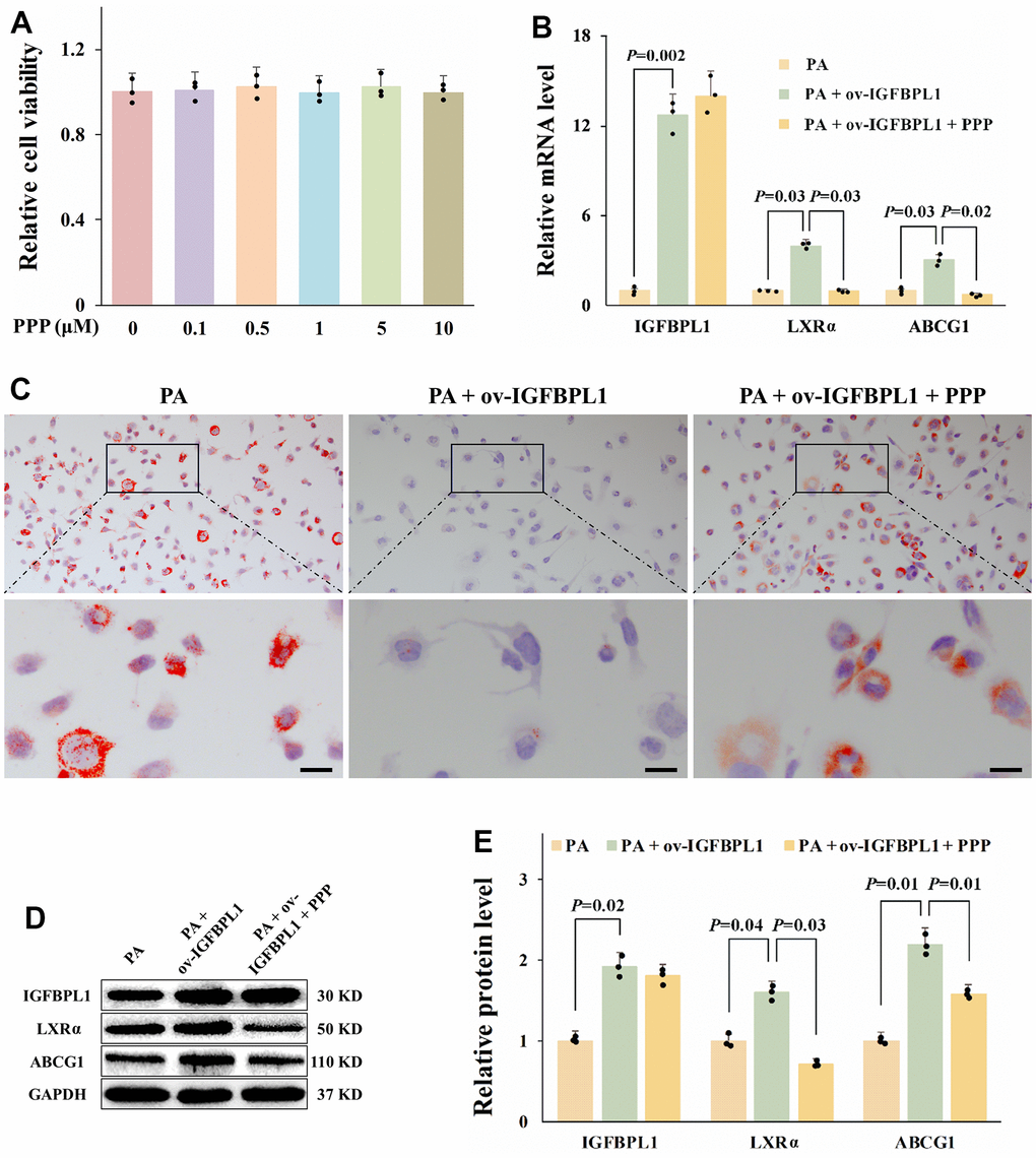 IGF-1R is critical for the anti-lipid accumulation effect of IGFBPL1 in macrophages. (A) Cell viability of THP-1 macrophages treated with PPP was detected by CCK-8. (B) Relative mRNA level of IGFBPL1, LXR and ABCG1 in THP-1 macrophages. (C) Representative images of oil red O staining. (D) WB was used to detect the protein level of LXR, ABCG1 and IGFBPL1 (n=3). (E) Quantitative statistics on WB results by ImageJ (n=3). PA: palmitic acid, PPP: picropodophyllin. PA + ov-IGFBPL1 + PPP, THP-1 was transfected for 24 h and then incubated with PA (100 μM) and PPP (1 μM) for 48 h. P