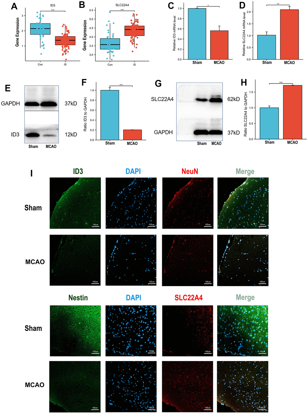 Expression validation in vivo models. (A) ID3 expression patterns in IS patients and controls in discovery set. (B) SLC22A4 expression patterns in IS patients and controls in discovery set. (C) The mRNA levels of ID3 in mouse brain tissues. (D) The mRNA levels of SLC22A4 in mouse brain tissues. (E, F) The protein levels of ID3 in mouse brain tissues. (G, H) The protein levels of SLC22A4 in mouse brain tissues. (I) The immunofluorescence levels of ID3 and SLC22A4 in mouse brain tissues. MCAO group and sham group, number of mice per group n=6.
