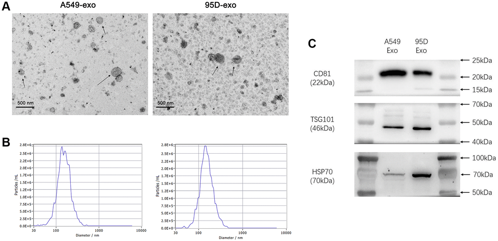 Analysis of precipitated exosomes isolated from supernatants of cultured tumor cells. (A) The morphology of exosomes was observed by TEM. (B) The exosomes were measured by NTA. (C) CD81, TSG101, and HSP70 were determined by western blot. Abbreviations: TEM: transmission electron microscopy; NTA: nanoparticle tracking analysis.