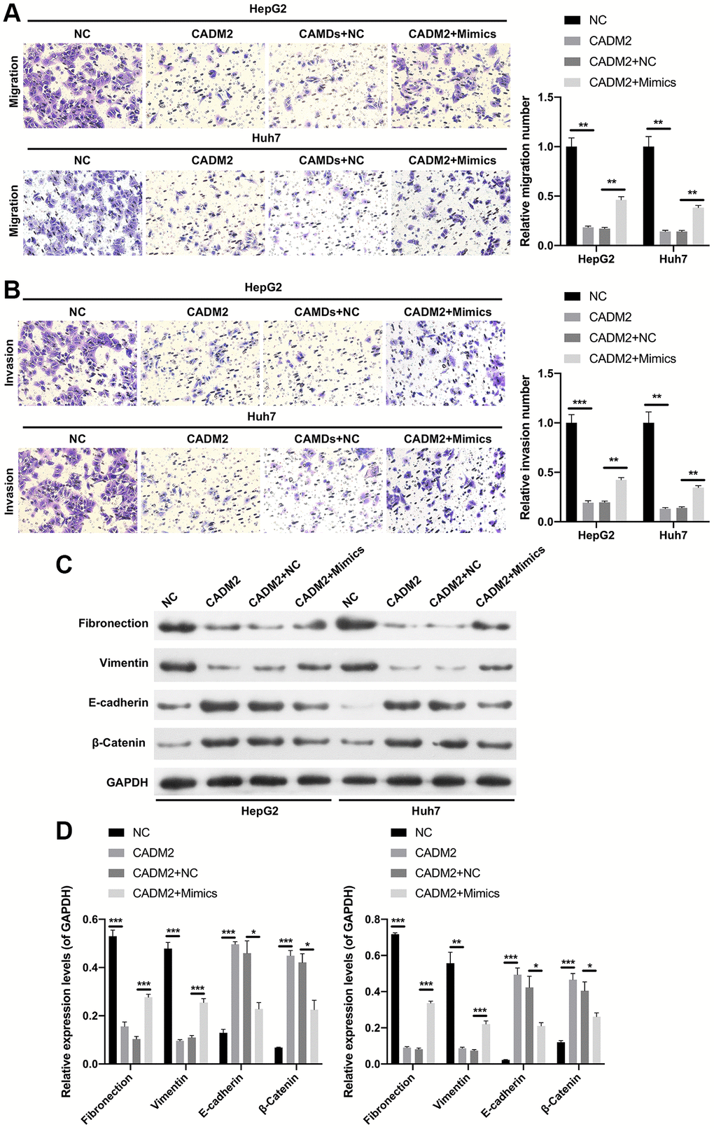 miR-1303 attenuated CADM2-mediated inhibition in migration and invasion of LC cells. HepG2 and Huh7 cells were transfected with miR-1303 mimics and circ