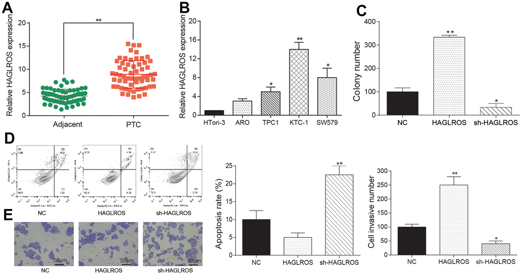Overexpressed lncRNA HAGLROS promoted proliferation and migration while repress apoptosis of PTC cells. (A) HAGLROS was highly expressed in PTC tissues. (B) The expression of HAGLROS in PTC cells was higher than normal cells. (C) HAGLROS promoted PTC cell proliferation. (D) HAGLROS inhibited PTC cell apoptosis. (E) HAGLROS enhanced cell invasion.