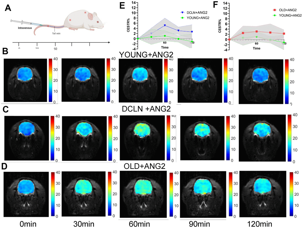 Angiopep-2 CEST MRI results for YOUNG and DCLN rats. (A) Intravenous injection of Angiopep-2 and measurement of CEST values at 0, 30, 60, 90, and 120 min. (B–D) Representative images for YOUNG, DCLN and OLD rats injected with Angiopep-2 (ANG2). (E) Comparison between YOUNG and DCLN rats (n=5). (F) Comparison between YOUNG and OLD rats (n=5).