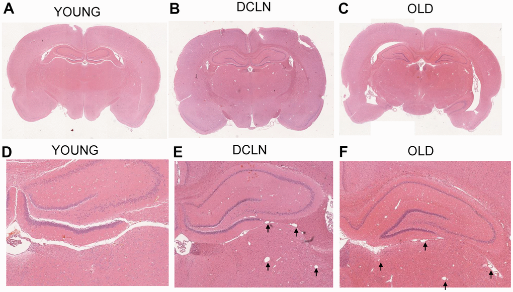 HE-staining histology results from YOUNG (A, D), DCLN (B, E), and OLD (C, F) SD rats. The black arrows indicate the dilated perivascular spaces in the brain.