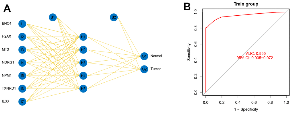 Seven oxidative stress-related genes detect early-stage liver cancer. (A) The model genes in the signature using the BP network were analyzed and the network was visualized. (B) The seven genes were used as a panel for early detection of liver cancer.
