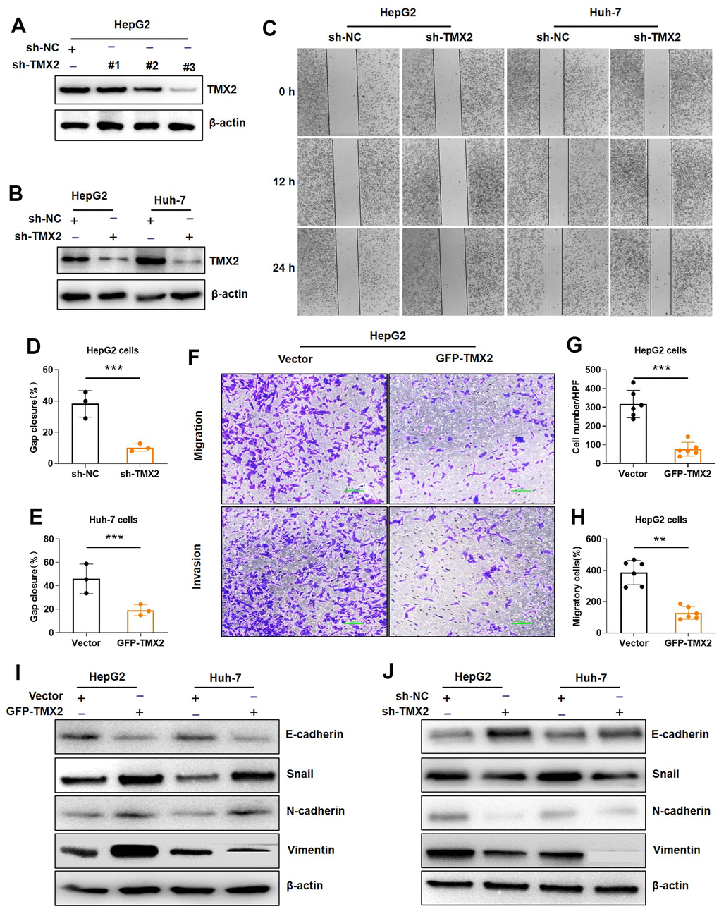 TMX2 promotes epithelial-mesenchymal transition (EMT) in liver cancer cells. Verification of sh-TMX2 (A). Transfection analysis of TMX2 (B). Microscopic observations were recorded at 0, 12, and 24 h after scratching the surface of a confluent layer of the indicated HepG2 and Huh-7 cells (C). Quantitative analysis of wound healing percentage in HepG2 cells (D). Quantitative analysis of wound healing percentage in Huh-7 cells (E). The effects of TMX2 on cell migration and invasion were examined by transwell assays in HepG2 cells (F). Quantitative analysis of cell migration in HepG2 cells (G). Quantitative analysis of cell invasion in HepG-2 cells (H). Western blot analysis of EMT marker expression in TMX2-overexpressing HepG2 and Huh-7 cells (I). Western blot analysis of EMT marker expression in TMX2-deficient HepG2 and Huh-7 cells (J). *p 