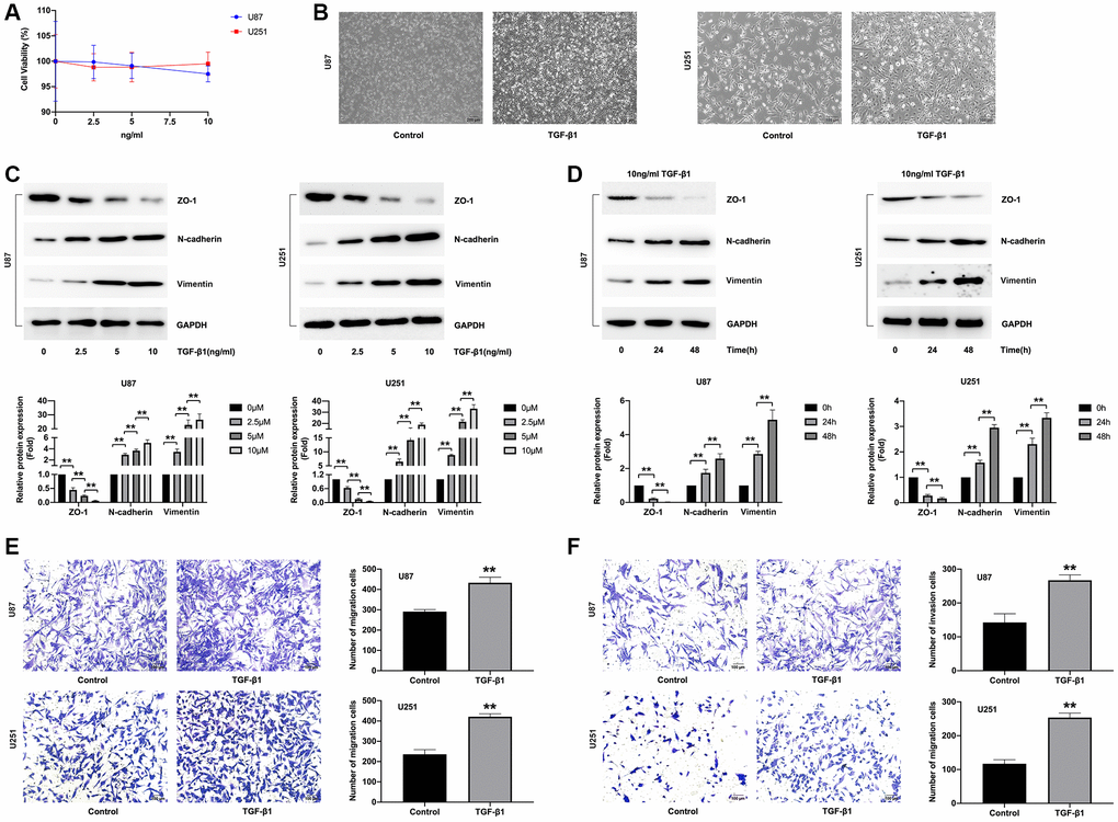 Effects of TGF-β1 on the EMT of glioma cells. (A) U87 and U251 cells were treated with the indicated concentrations of TGF-β1 (0, 2.5, 5 and 10 ng/mL) for 48 h, and then cell viability was detected using CCK-8 assay. (B) Effects of 10 ng/mL TGF-β1 on morphology of U87 and U251 cells. (C, D) U87 and U251 cells were treated with 10 ng/mL TGF-β1 for 48 h, and then the expression of ZO-1, N-cadherin and Vimentin proteins were detected by Western blot analyses. (E) Assessment of U87 and U251 cell invasion in response to 10 ng/mL TGF-β1 used a light microscope following Matrigel migration assay staining. (F) Assessment of U87 and U251 cell invasion in response to 10 ng/mL TGF-β1 used a light microscope following Matrigel invasion assay staining.