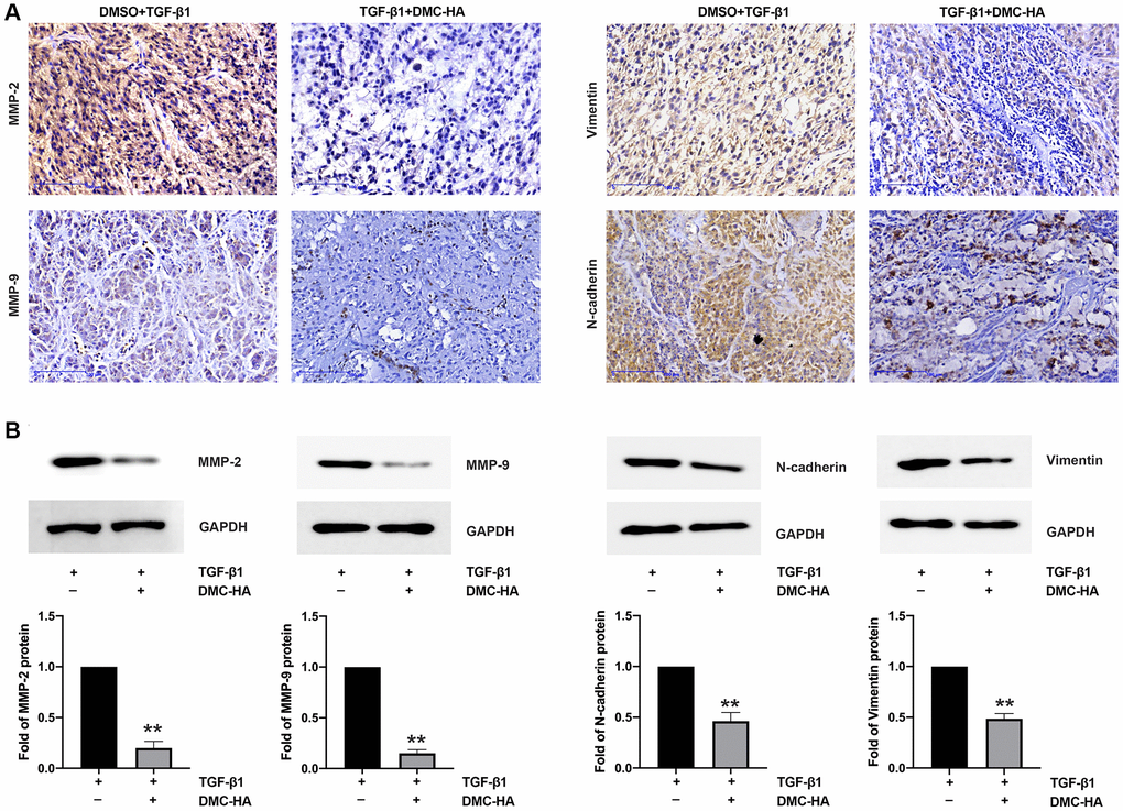 DMC-HA inhibited TGF-β1 induced EMT in vivo. (A) Immunohistochemical (IHC) staining was performed to evaluate the expression of MMP-2, MMP-9, N-cadherin, and Vimentin in tumor tissues treated with DMC-HA and/or TGF-β1. (B) Western blot analysis was carried out to examine the expression levels of MMP-2, MMP-9, N-cadherin, and Vimentin in tumor tissues treated with DMC-HA and/or TGF-β1.