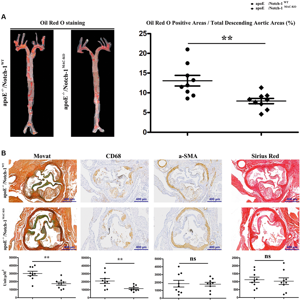 Specific deletion of Notch-1 in macrophage repressed AS. (A) Oil red O staining in thoracic aortas and quantitative analysis revealed that Notch-1MAC-KO significantly decreased the atherosclerotic plaques compared with Notch-1WT. **P −/−/Notch-1MAC-KO vs. ApoE−/−/Notch-1WT. (B) Movat, α-SMA, CD68 and Sirius red staining and quantitative analysis revealed that Notch-1MAC-KO could decrease plaque cellularity (Movat staining) and macrophage infiltration (CD 68) compared with Notch-1WT. However, there was no significant difference in smooth muscle cell content (α-SMA staining) and fibrotic lesions (Sirius red staining) between the two groups. **P −/−/Notch-1MAC-KO vs. ApoE−/−/Notch-1WT.