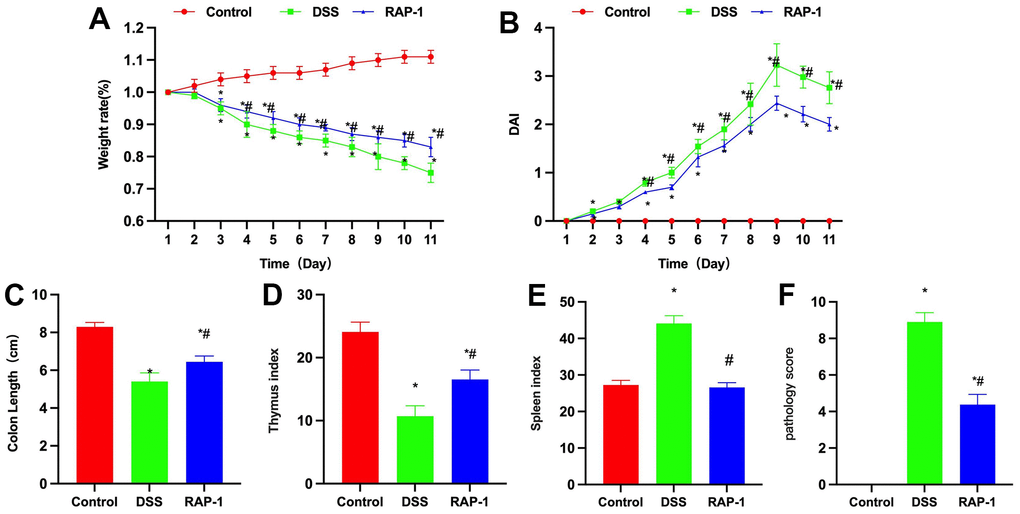 Effects of RAP1 on life and pathological score in colitis mice. (A) Dynamic weight monitoring (n= 10). DSS could induce weight loss in mice, while RAP1 could slow down such weight loss trend. (B) DAI scoring (n= 10). DSS mice exhibited increase in the DAI score. RAP1 mice displayed significantly lower DAI score than the DSS mice, albeit certain increase. (C) Intestinal length measurement (n= 10). Intestinal length was shortened in the DSS group, which was shorter than that in the RAP1 group. (D, E) Thymus and spleen indices (n= 10). DSS group exhibited lower thymus index and higher spleen index than the Control group. RAP1 could heighten the thymus index and lower the spleen index. (F) Pathological scoring (n= 10). Control mice scored 0, while significant score reduction was noted in the RAP1 group, showing lower value than the DSS group. *P