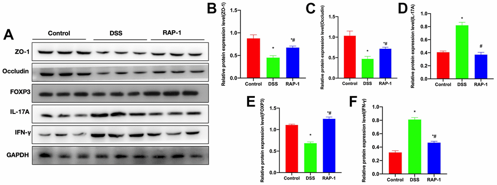 Relative protein expressions (n= 3). (A–F) DSS group exhibited downregulations of ZO-1, Occludin and FOXP3, whereas upregulations of IL-17A and IFN-γ. RAP1 could elevate the ZO-1, Occludin and FOXP3 levels, and lower the IL-17A and IFN-γ levels. *P