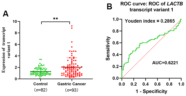 LACTB transcript variant 1 expression and diagnosis in peripheral venous blood of gastric cancer patients. (A) Expression level of LACTB transcript 1 in venous peripheral blood of gastric cancer patients. (B) ROC curve of LACTB transcript variant 1. **P
