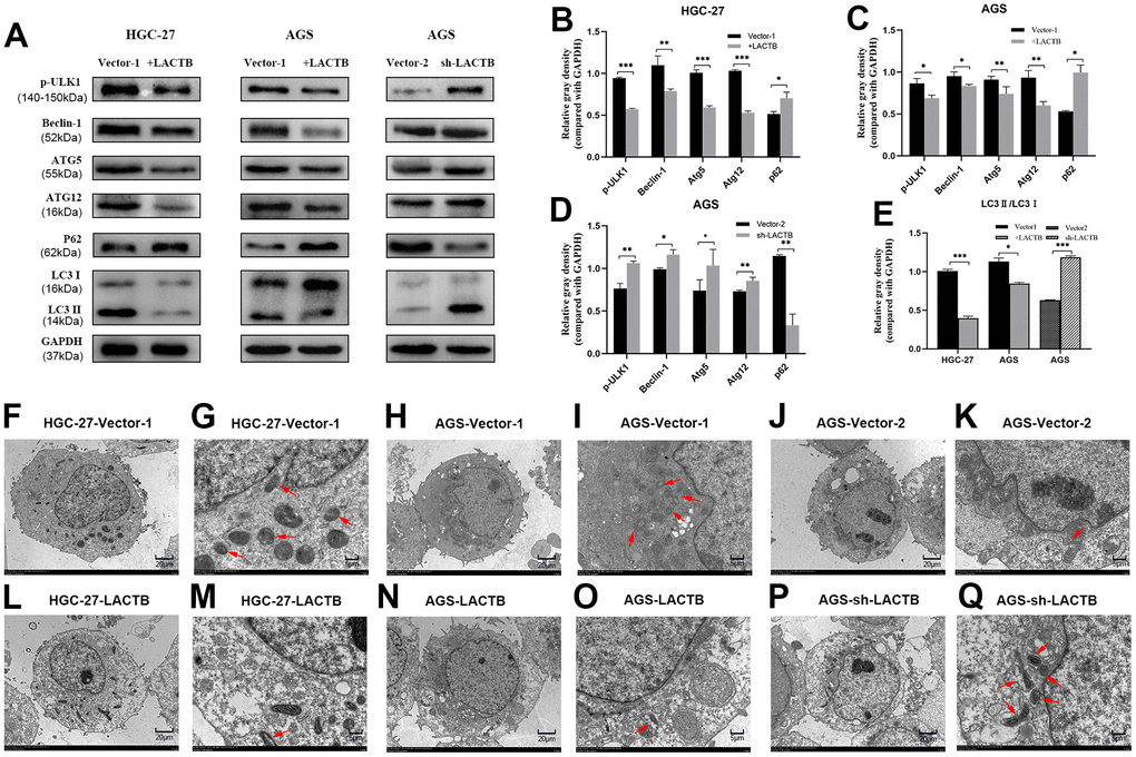 The effect of LACTB on the autophagy-related proteins in gastric cancer cells. (A) Expression levels of autophagy-related proteins in HGC-27-LACTB, AGS-LACTB, AGS-sh-LACTB; (B–E) Bar graphs of autophagy-related protein expression levels; (F–Q) The effect of LACTB on autophagosome formation. The red arrow indicates the autophagosome. (F, H, J, L, N) P×2.5 k; (G, I, K, M, O) Q× 8.0 k; *P**P***P