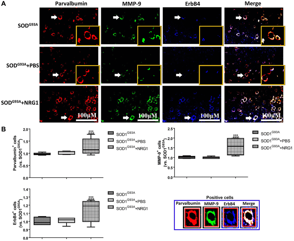 Recombinant NRG1 enhanced the levels of ErbB4, PV and MMP-9 in ALS mice. The expression of ErbB4, PV and MMP-9 were determined by immunofluorescence in control mice and mice treated with 0.5 mg/kg NRG1. The yellow boxes represent the typical positive cells (enlarged approximate twice on the original position). The typical PV, MMP-9 and ErBb4 positive cells are enlarged approximate 4 times and shown on the bottom right panel. Scale bar = 100 μM (A) and the quantified results (B) in mice at 130~140 days. ***P G93A. ###P G93A+PBS. In all experiments, half male and half female mice were used in each group (n = 6).