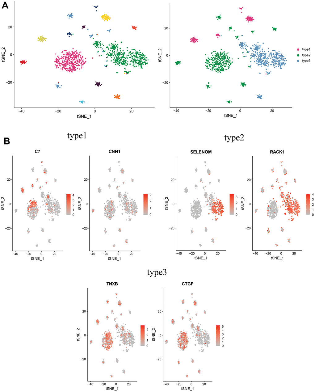 Distinguishing new subtypes of CAFs. (A) tSNE plot of CAFs with reduced dimensional clustering; (B) tSNE plot of maker genes for 3 cell subpopulations.