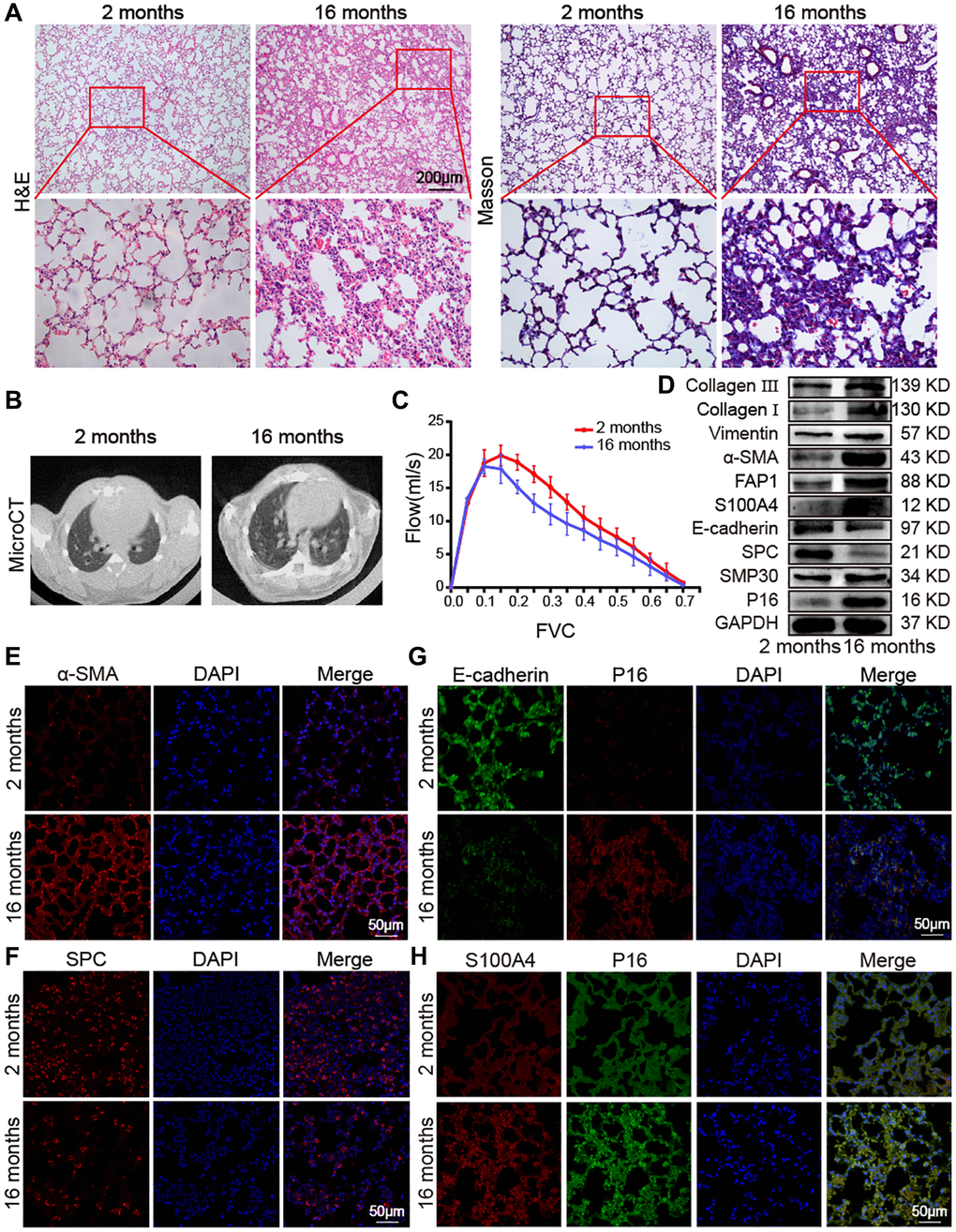 Impact of aging on mouse lung. (A) H&E and Masson staining showed that the alveolar structure of the lung tissue of 2-month-old mice was clear and intact, whereas the lung tissue of 16-month-old mice had more collagen deposition, damaged alveolar structure, and thickened alveolar walls. (B) MicroCT imaging for small animal demonstrated that some old mice had fibrous strip shadows and thickened interlobular septa compared with young mice. (C) FVC results showed that pulmonary function decreased in aging mice. (D) Western blot showed that collagen III, collagen I, vimentin, α-SMA, FAP1, S100A4, SMP30, and P16 increased significantly in aging mice, but E-cadherin and SPC decreased. (E) Immunofluorescence staining showed that α-SMA expression in lung tissues of aging mice was higher than in those of young mice. (F) Immunofluorescence images showed that SPC expression was significantly lower in lung tissue of 16-month-old mice than in that of 2-month-old mice. (G) Double immunofluorescence staining showed that P16 increased in aging mice and decreased in young mice. E-cadherin decreased in aging mice and increased in young mice. (H) Double immunofluorescence staining showed that the expression of S100A4 and P16 in the lung tissue of aging mice were significantly higher than in that of young mice.