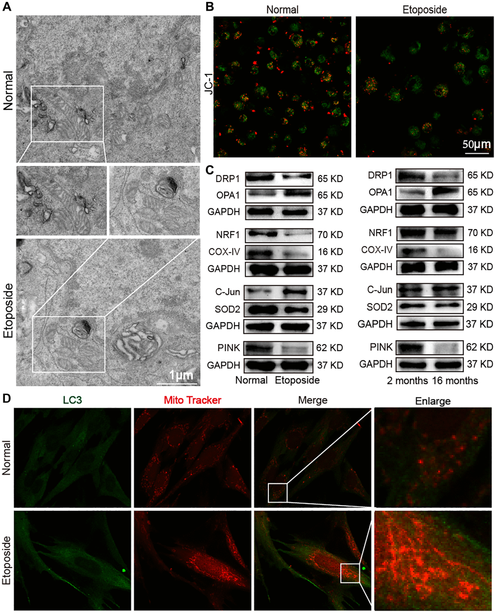 Dysfunctional mitochondria in the aging model in vivo and in vitro. (A) TEM examination showed mitochondrial crumpling, disrupted integrity of the outer mitochondrial membrane, and reduced mitochondrial cristae in the aging group. (B) Detection of mitochondrial membrane potential by laser scanning confocal microscopy revealed decreased red fluorescence and increased green fluorescence in senescent cells. Red fluorescence indicated JC-1 polymer; green fluorescence indicated JC-1 monomer. (C) Western blot showed increased expression levels of OPA1 and C-Jun in the senescent cell model and decreased expression levels of DRP1, NRF1, COX-IV, SOD2, and PINK with the same expression trend in the aging mice model. (D) Double immunofluorescence assay showed increased mitochondria (red fluorescence) and LC3 (green fluorescence) in senescent cells compared with normal ones. Mitochondria in the normal group showed an extended tubular structure, and in the etoposide group mitochondria were rounded and fragmented.