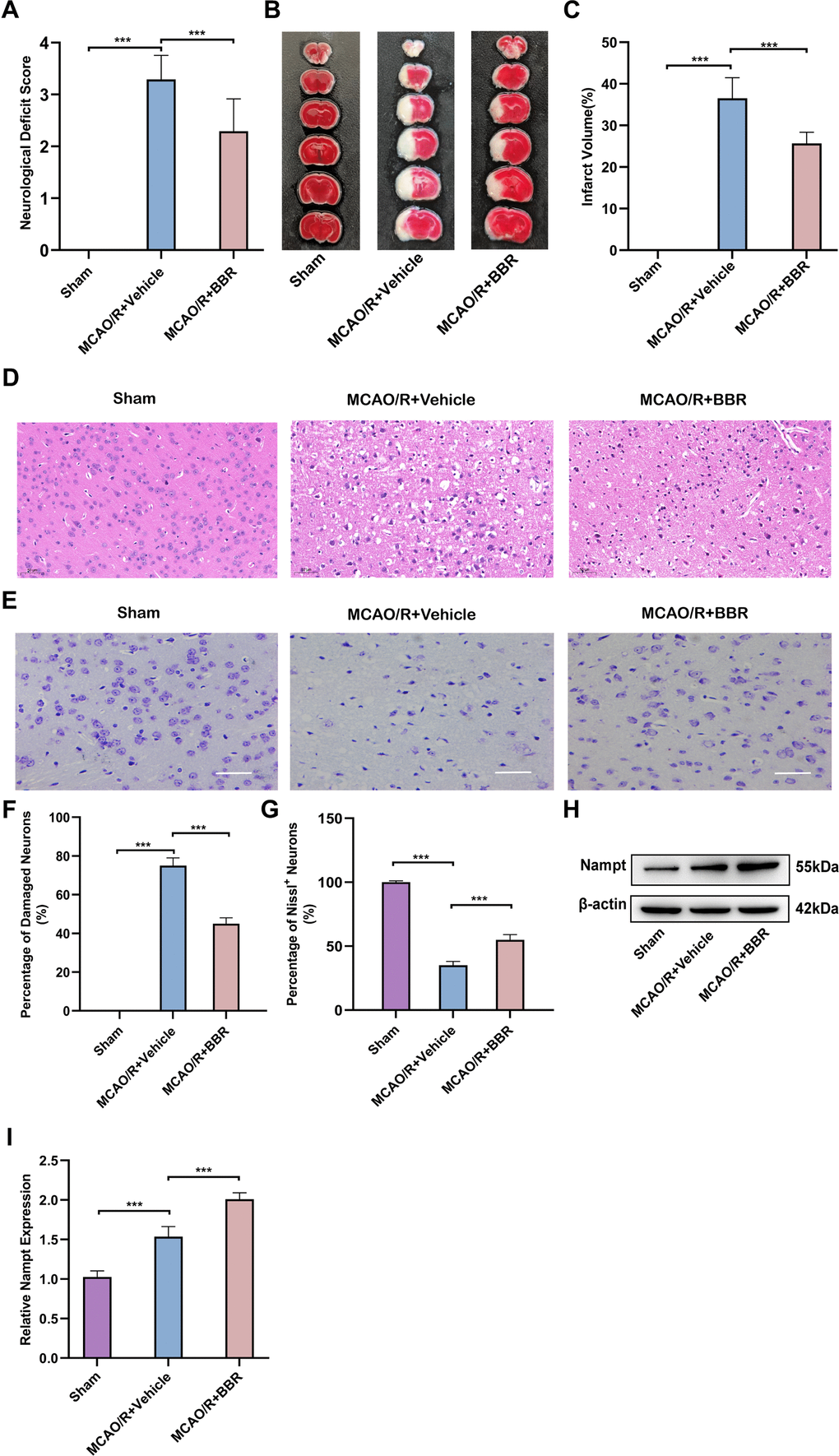 Berberine alleviates MCAO/R brain injury and up-regulates the expression of Nampt in adult mouse astrocytes. (A) Neurologic function scores for assessing the degree of neurological impairment after 24 hours in sham, MCAO/R+Vehicle or BBR+ MCAO/R group of mice (n=24). (B) Representative images of TTC-stained brain sections from mice (n=6). (C) Quantification of infarct volume at 24 h after MCAO/R (n=6). (D) Representative images of HE staining of ischemic brain tissue from mice (n=6, Scale bar: 50 μm). (E) Representative images of Nissl staining of ischemic brain tissue from mice (n=6, Scale bar: 50 μm). (F) Quantification of damaged neurons. (G) Quantification of Nissl+ neurons. (H) Representative Western blot images depicting Nampt in adult mouse astrocytes (n=6). (I) A bar presenting the quantification of Nampt (n=6). The relative expression levels were quantified by normalizing to β-actin. Data are represented as mean ± SD, (*P P P 