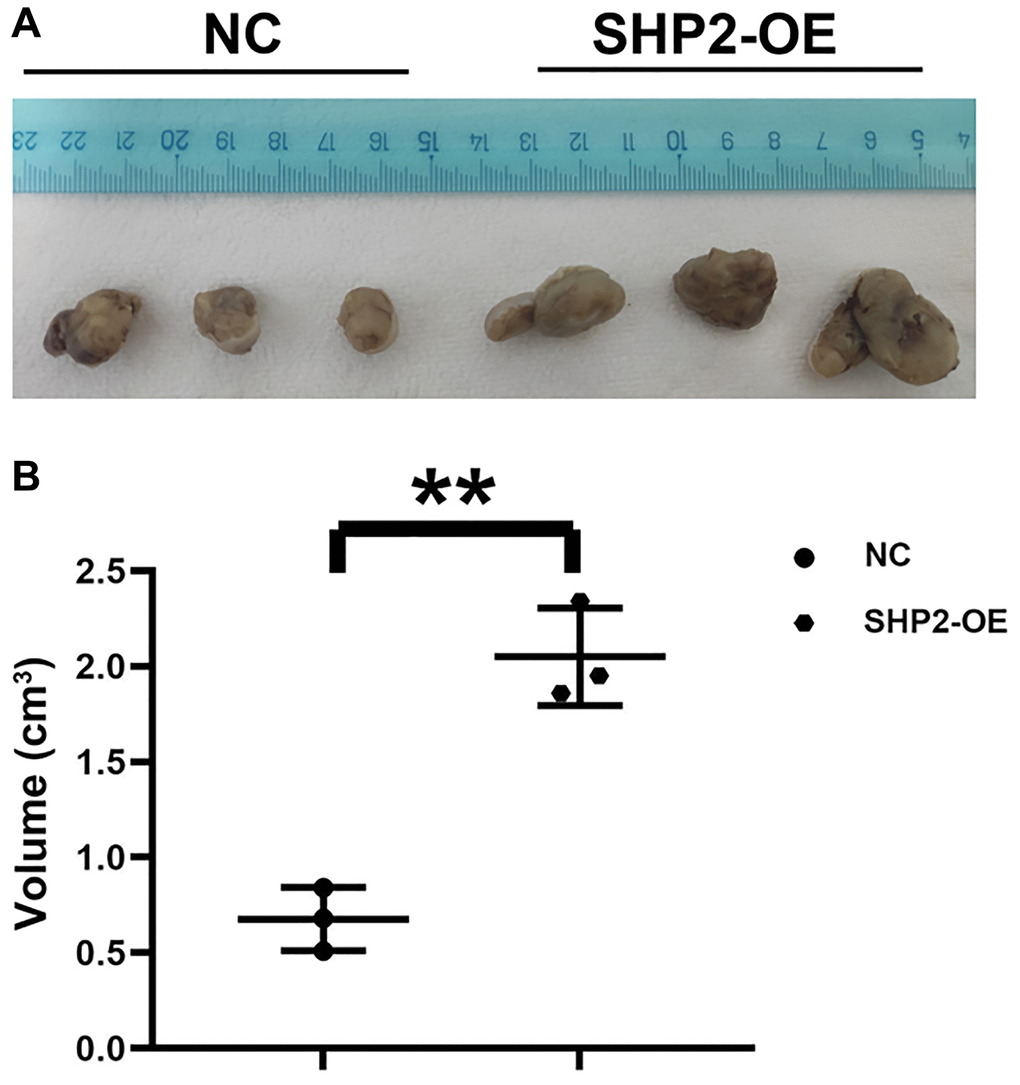 SHP2 in TAM can promote the progression of gastric cancer. (A) Results of nude mouse tumor-bearing experiment; (B) Tumor volume statistics of nude mice. **P 