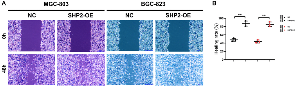 SHP2 in TAM can promote the migration of gastric cancer. (A) Results of wound healing assay at 0 h and 48 h; (B) Statistics of cell healing rate. **P 