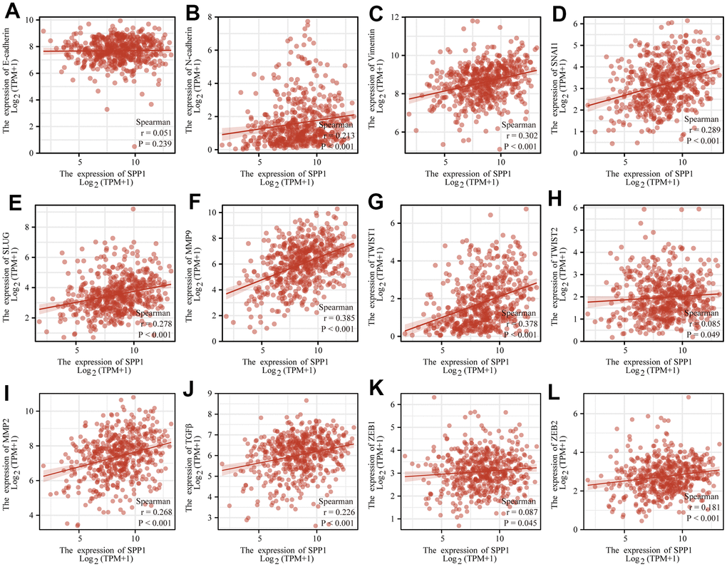 SPP1 expression correlated with EMT signatures in LUAD. SPP1 expression connected with (A) E-cadherin, (B) N-cadherin, (C) Vimentin, (D) SNAI1, (E) SLUG, (F) MMP9, (G) TWIST1, (H) TWIST2, (I) MMP2, (J) TGFβ, (K) ZEB1, and (L) ZEB2.