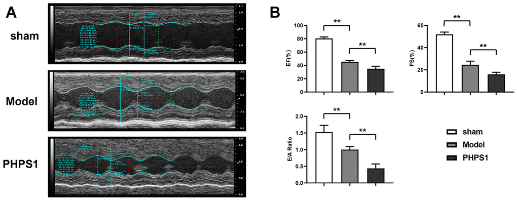 Ultrasound electrocardiogram examination results of mice in each group. (A) Left ventricular echocardiography of mice; (B) Statistical results of LVEF, LVFS, E/A ratios of left ventricle in mice, data was presented as X±S. Comparisons between sham group and model group, **p