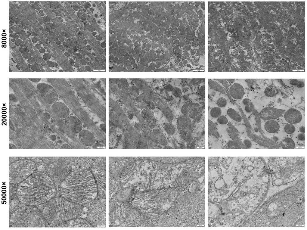 Transmission electron microscopic examination of myocardial cells in each group.