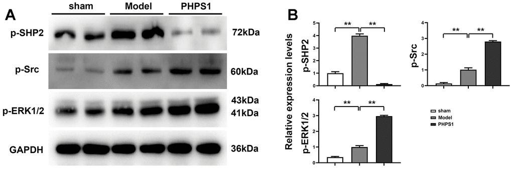 Western blot results of p-SHP2, p-Src and p-ERK protein in myocardial cells of mice in each group. (A) Western blot results of p-SHP2, p-Src and p-ERK1/2 in mouse cardiomyocytes in each group; (B) Statistical diagram of the expression levels of p-SHP2, p-Src and p-ERK1/2 proteins in mouse cardiomyocytes in each group, and the data was shown as X±S. Comparisons between sham group and model group, **p