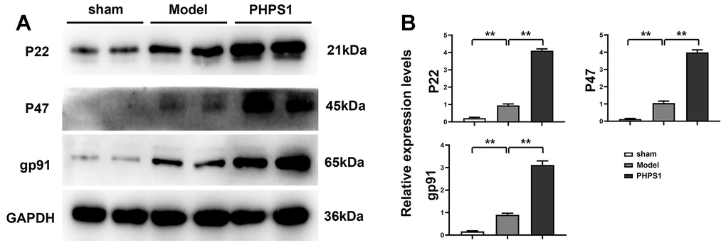 Western blot results of oxidative stress related proteins in myocardial cells of mice in each group. (A) Western blot results of P22, P47 and gp91 in mouse cardiomyocytes in each group; (B) Statistical plots of P22, P47 and gp91 expression levels in mice cardiomyocytes in each group, and the data was shown as X±S. Comparisons between sham group and model group, **p