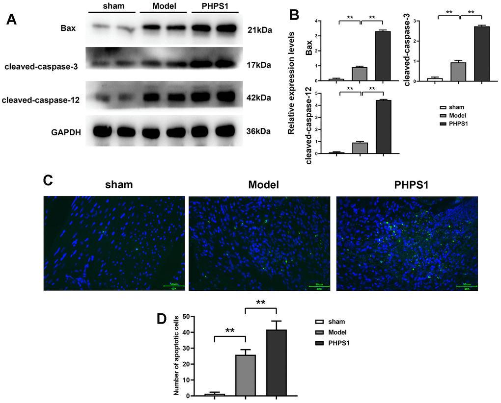 Results of the expression of apoptosis-related proteins in mouse cardiomyocytes and the cell apoptosis condition. (A) Western blot results of Bax, cleaved-Caspase-3 and cleaved-Caspase-12 in mouse cardiomyocytes in each group; (B) Statistical plot of Bax, cleaved-Caspase-3 and cleaved-Caspase-12 expression levels in mouse cardiomyocytes in each group; (C) Plot of TUNEL assay results; (D) Apoptotic cell count statistics, data was shown as X±S. Comparisons between sham group and model group, **p