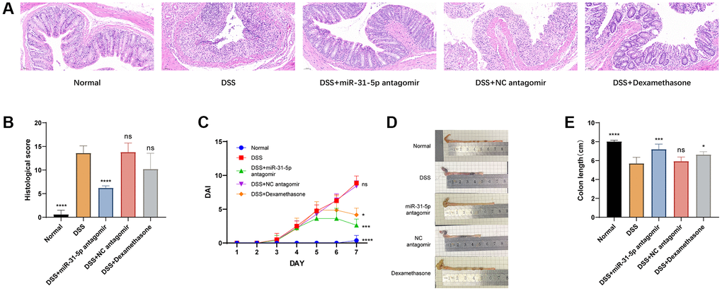 Antagomir of miR-31-5p modulates macrophage polarization via the AMPK ...