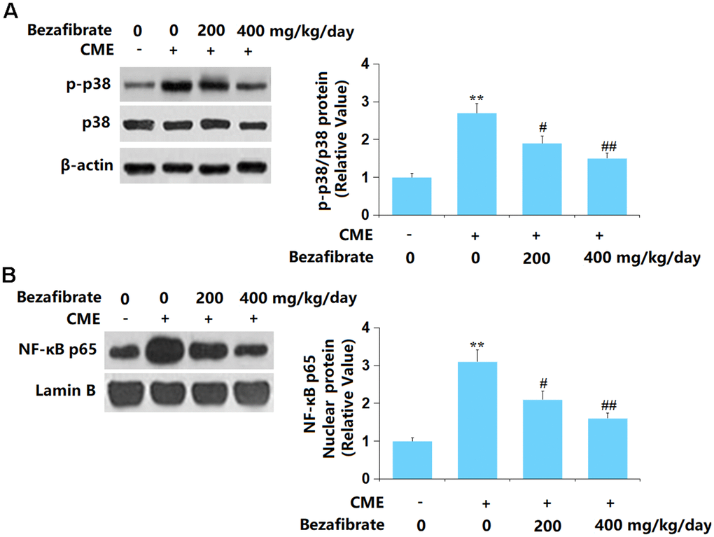 Bezafibrate prevented activation of the p38 MAPK/NF-κB signaling after CME induction. (A) The levels of p-p38/p38; (B) Protein expression of nuclear NF-κB p65 (n=12, **, p#, ##, p