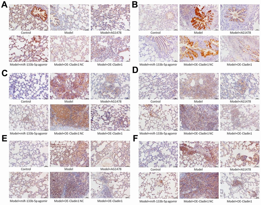 Immunohistochemistry detects the expression of proteins in lung tissue note: (A) Claudin1 protein expression; (B) Expression of MUC5AC protein; (C) p-EGFR protein expression; (D) p-ERK1/2 protein expression; (E) p-JNK protein expression; (F) P-P38 protein expression.