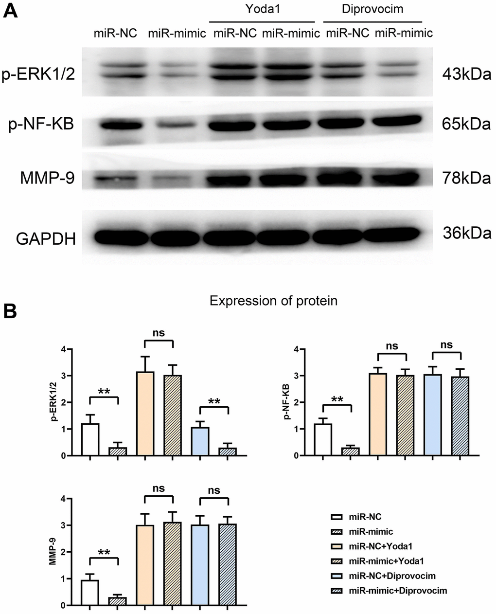 Overexpression of miR-361-5p inhibits the expression of MMPs by inhibiting the ERK1/2/NF-κB signaling pathway. (A) Protein band plots of p-ERK1/2, p-NF-κB and MMP9. (B) Relative protein expression statistics of p-ERK1/2, p-NF-κB and MMP9. N = 3; **P nsP > 0.05, miR-NC+Yoda1 vs. miR-mimic+Yoda1, miR-NC+Diprovocim vs. miR-mimic+Diprovocim.
