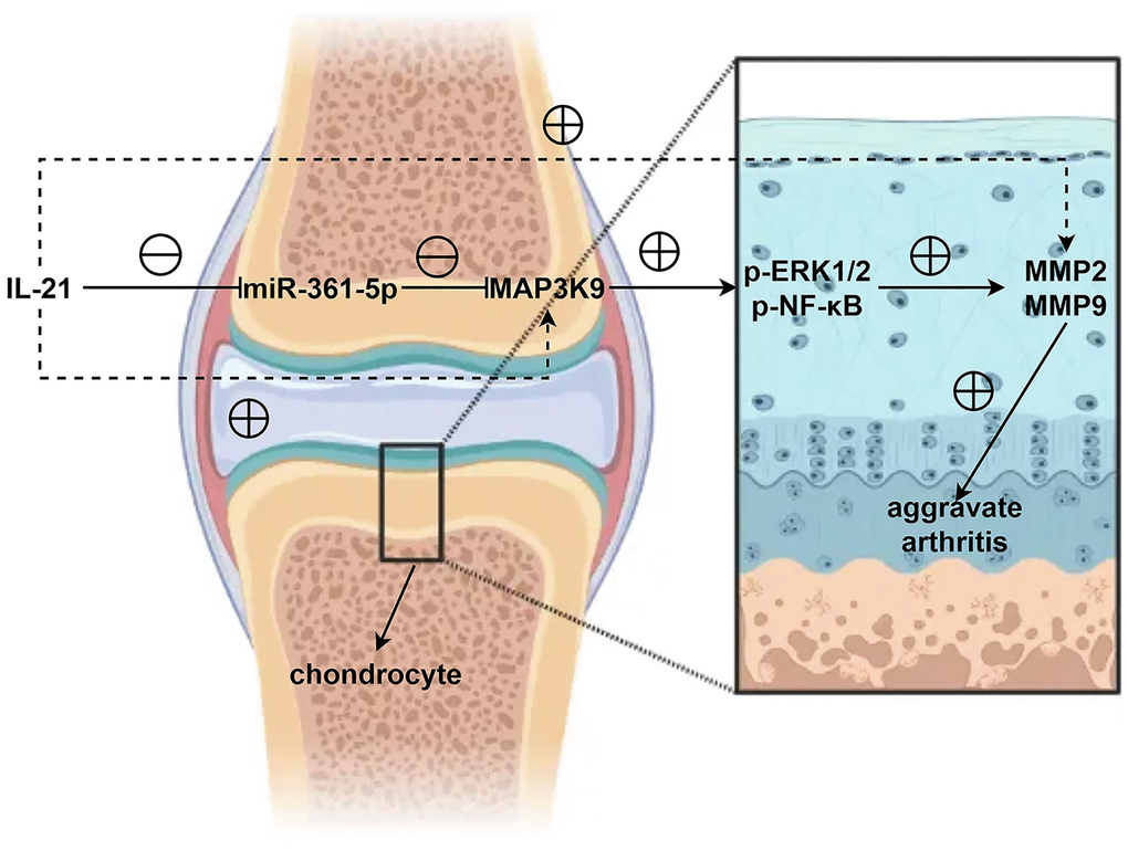 In shoulder arthritis, IL21 can inhibit the expression of miR-361-5p in chondrocytes thereby mediating MAP3K9 in chondrocytes to promote the activation of the ERK1/2/NF-κB signaling pathway, further inhibiting the expression and secretion of MMPs and aggravates the progression of shoulder arthritis.