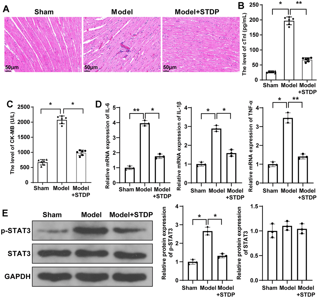 STDP can attenuate myocardial injury in CME rats and regulate STAT3 signal pathway. Note: (A) H&E staining on myocardial tissues, scale bar of 100 μm; (B, C) Serum levels of cTnI and CK-MB detected by ELISA; (D) qRT-PCR detected the expressions of inflammatory cytokines IL-6, IL-1β and TNF-α in myocardial tissues; (E) Western blot detected the protein expressions of STAT3 signal pathway related proteins. *P 