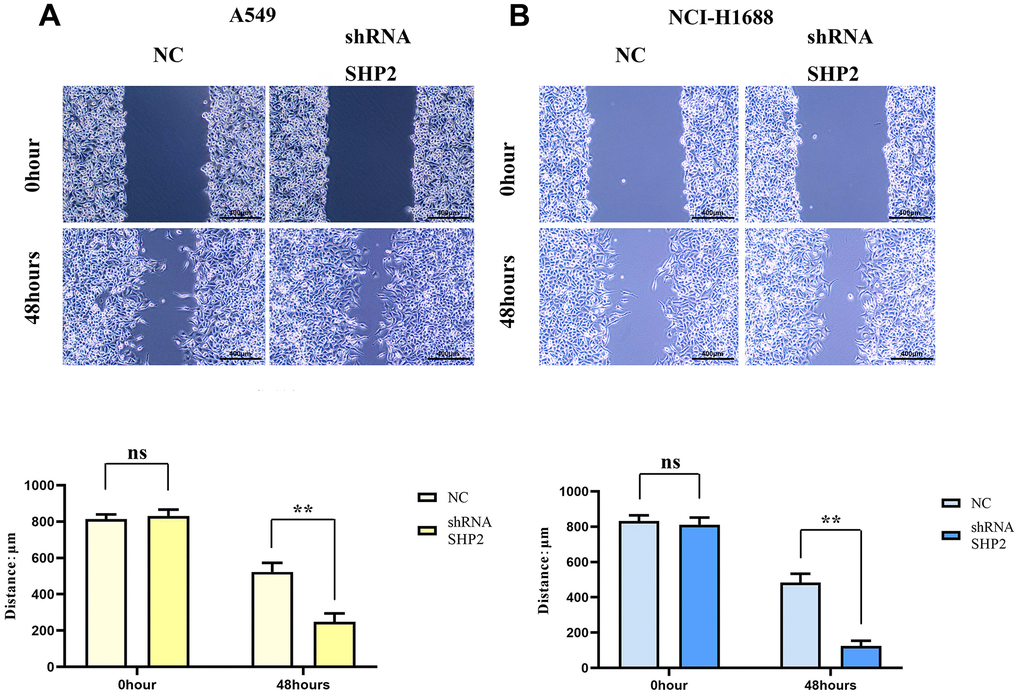 Inhibition of SHP2 in TAM can enhance the migration ability of lung adenocarcinoma cells. (A) Cells healing assay and data statistics of A549 cells; (B) Cells healing assay and data statistics of NCI-H1688 cells. 40×,1824 pixels×1216 pixels,400 μm;N=3;**P0.05.