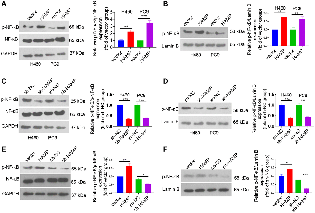 HAMP upregulated the NF-κB pathway in NSCLC cells. (A–F) HAMP-overexpressing or HAMP-knockdown H460 and PC9 cells were generated. Western blot analysis revealed p-NF-κB p65 protein levels in whole cells and in the nucleus. *P **P ***P n = 3.