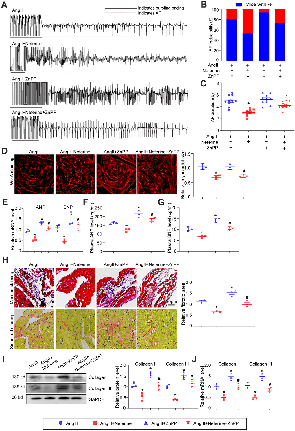 Inhibition of HO-1 partially abolished the protective role of neferine in Ang II-induced AF, atrial cell size augmentation, and fibrosis. (A) AF records in each group. (B, C) Average AF incidence and duration induced by burst pacing (n = 10). (D) Representative images of WGA staining of atrial sections illustrating atrial cell size, with the cell area in each group quantified (n = 3, on the right). Scale bar: 50 μm. (E) Measurement of ANP and BNP mRNA levels by qPCR (n = 3, on the right). (F, G) Plasma ANP and BNP levels assessed by Elisa kit (n = 3). (H) Representative images of Masson's trichrome and Sirius Red-stained atrial sections indicating the degree of fibrosis, with the fibrotic area in each group quantified (n = 5, on the right). Scale bar: 50 μm. (I) Western blot analysis of collagen I and III protein expression in the atria, with the corresponding statistical results on the right (n = 3). (J) Measurement of collagen I and III mRNA levels by qPCR (n = 3). Data are presented as mean ± SEM, and n represents the number of samples. Data are presented as mean ± SEM, and n represents the number of samples. *P #P 