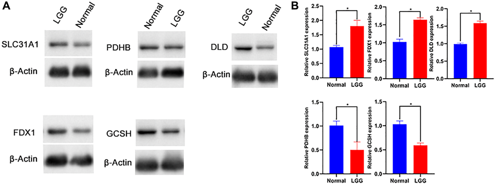 Western blot (A, B) of SLC31A1, FDX1, DLD, GCSH, PDHB protein.