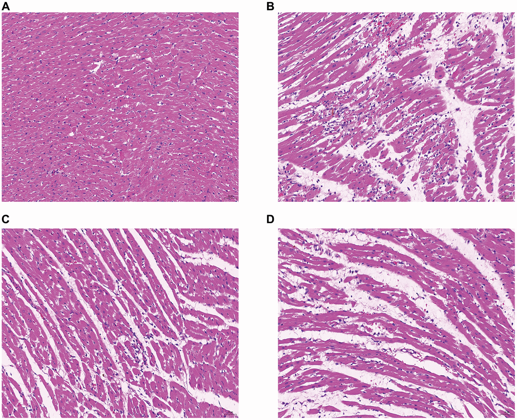 Morphology of rat cardiomyocytes in each group (HE staining, ×20). (A) Normal group (B) Model group (C) DXTMG group (D) Propranolol group.