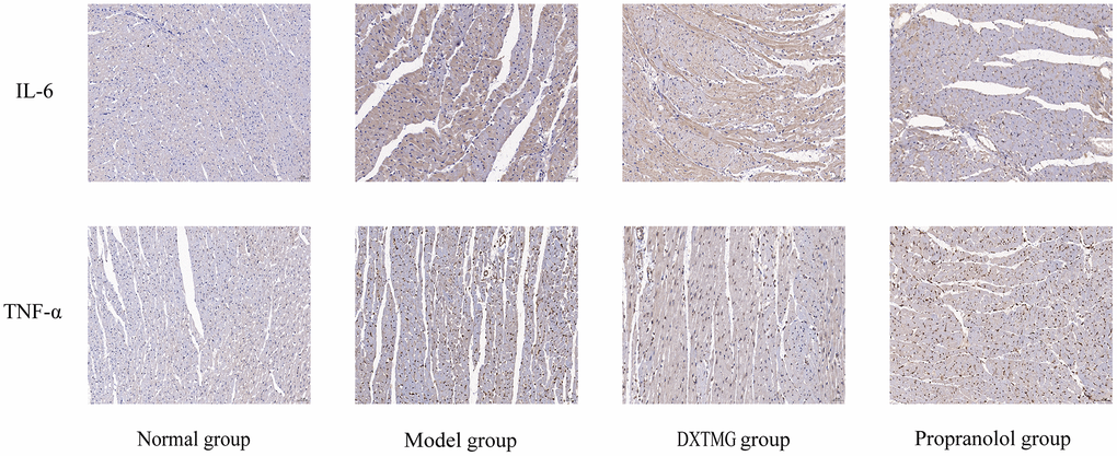 Immunohistochemistry of cellular IL-6 and TNF-α expression in rat cardiomyocytes from 4 groups (×20).
