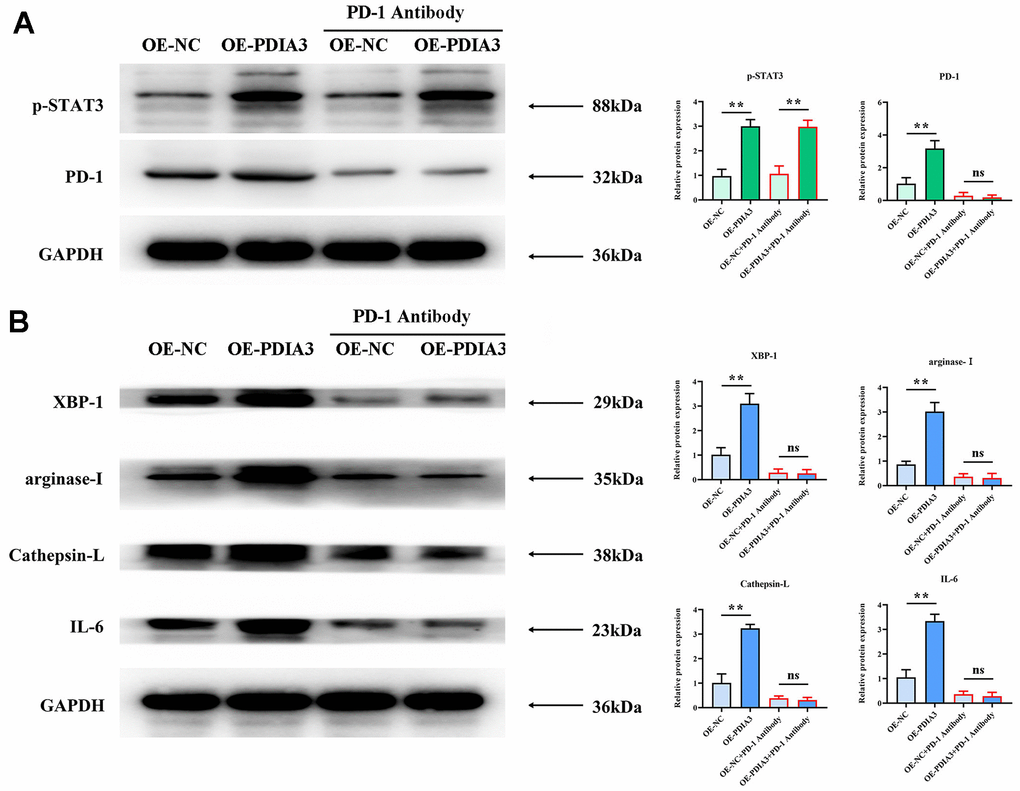 Application of PD-1 antibody to substantiate PDIA3’s role in endorsing M2 polarization of tumor-associated macrophages and prompting tissue protease secretion, mediated by STAT3/PD-1 signaling modulation. (A) Protein levels of pSTAT3 and PD-1 in cells with PDIA3 overexpression versus or-NC control, and PD-1 inhibitor versus PD-1 NC treatment assessed by western blot (n=3 per group). Statistical evaluation via T-test,* *P B) Levels of XBP-1, arginase-1, cathepsin-L, cathepsin-K, and IL-6 proteins in THP-1 cells under differing conditions of PDIA3 expression and PD-1 inhibition, determined via western blot (n=3 per group). Statistical evaluation via T-test,* *P 